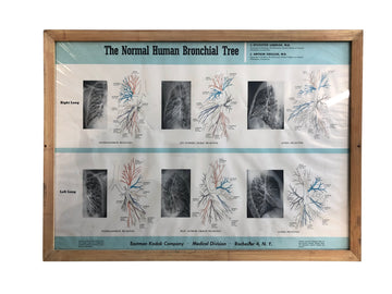 Human Bronchial Tree Print
